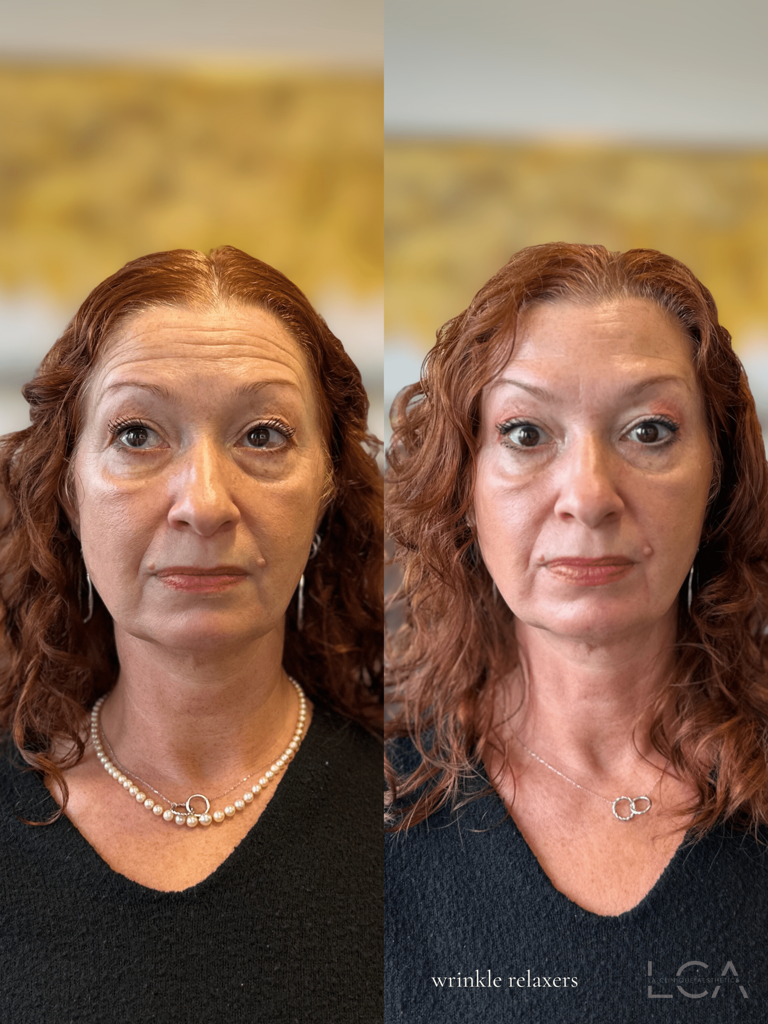 Copy of Before and Afters (NEW Portrait Size).zip 16