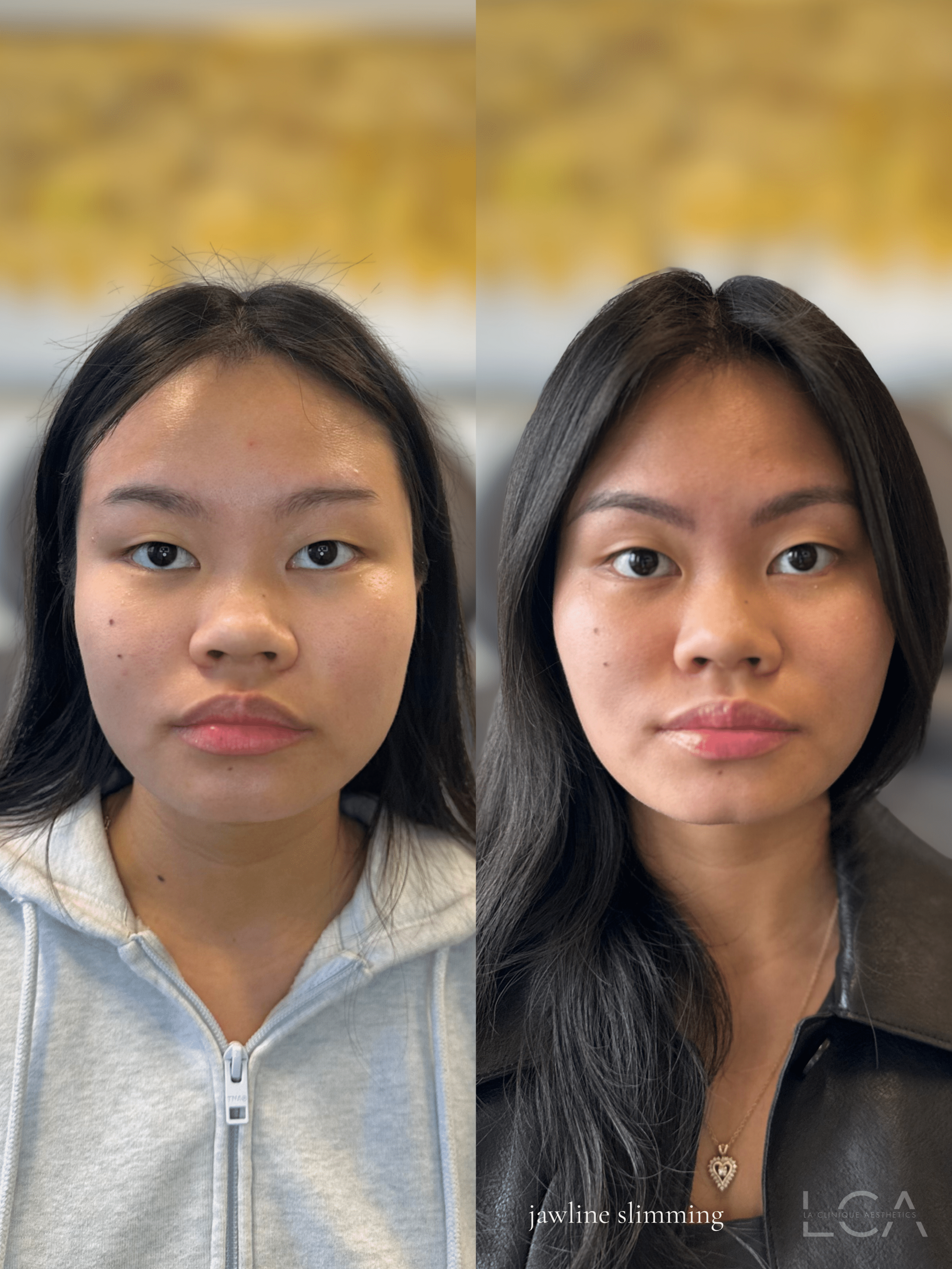 Copy of Before and Afters (NEW Portrait Size).zip 17